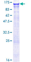 VPS54 Protein - 12.5% SDS-PAGE of human VPS54 stained with Coomassie Blue