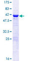 Vps60 / CHMP5 Protein - 12.5% SDS-PAGE of human CHMP5 stained with Coomassie Blue