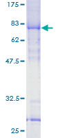 VPS72 Protein - 12.5% SDS-PAGE of human TCFL1 stained with Coomassie Blue