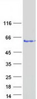VPS72 Protein - Purified recombinant protein VPS72 was analyzed by SDS-PAGE gel and Coomassie Blue Staining