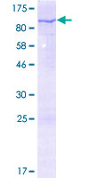 VPS9D1 / C16orf7 Protein - 12.5% SDS-PAGE of human C16orf7 stained with Coomassie Blue