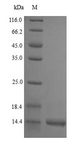 vpx Protein - (Tris-Glycine gel) Discontinuous SDS-PAGE (reduced) with 5% enrichment gel and 15% separation gel.