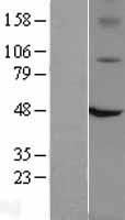 VR1 / TRPV1 Protein - Western validation with an anti-DDK antibody * L: Control HEK293 lysate R: Over-expression lysate