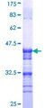 VR1 / TRPV1 Protein - 12.5% SDS-PAGE Stained with Coomassie Blue.