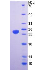VR1 / TRPV1 Protein - Recombinant  Transient Receptor Potential Cation Channel Subfamily V, Member 1 By SDS-PAGE