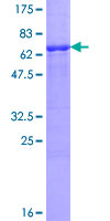 VRK1 Protein - 12.5% SDS-PAGE of human VRK1 stained with Coomassie Blue