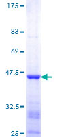 VRK1 Protein - 12.5% SDS-PAGE Stained with Coomassie Blue.