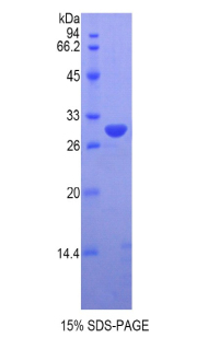 VRK1 Protein - Recombinant Vaccinia Related Kinase 1 By SDS-PAGE