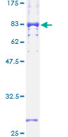 VRK2 Protein - 12.5% SDS-PAGE of human VRK2 stained with Coomassie Blue
