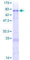 VRK3 Protein - 12.5% SDS-PAGE of human VRK3 stained with Coomassie Blue