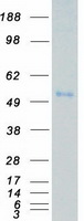 VRK3 Protein - Purified recombinant protein VRK3 was analyzed by SDS-PAGE gel and Coomassie Blue Staining