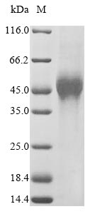 VSIG1 Protein - (Tris-Glycine gel) Discontinuous SDS-PAGE (reduced) with 5% enrichment gel and 15% separation gel.