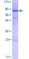 VSIG1 Protein - 12.5% SDS-PAGE of human VSIG1 stained with Coomassie Blue