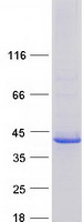VSIG2 Protein - Purified recombinant protein VSIG2 was analyzed by SDS-PAGE gel and Coomassie Blue Staining