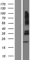 VSIG4 Protein - Western validation with an anti-DDK antibody * L: Control HEK293 lysate R: Over-expression lysate
