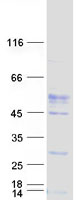 VSIG4 Protein - Purified recombinant protein VSIG4 was analyzed by SDS-PAGE gel and Coomassie Blue Staining