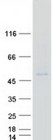 VSIG8 Protein - Purified recombinant protein VSIG8 was analyzed by SDS-PAGE gel and Coomassie Blue Staining
