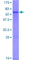 VSIR / GI24 / VISTA Protein - 12.5% SDS-PAGE of human C10orf54 stained with Coomassie Blue