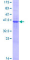 VSTM1 Protein - 12.5% SDS-PAGE of human UNQ3033 stained with Coomassie Blue