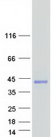 VSTM1 Protein - Purified recombinant protein VSTM1 was analyzed by SDS-PAGE gel and Coomassie Blue Staining
