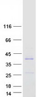 VSTM2B Protein - Purified recombinant protein VSTM2B was analyzed by SDS-PAGE gel and Coomassie Blue Staining