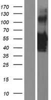 VSX1 Protein - Western validation with an anti-DDK antibody * L: Control HEK293 lysate R: Over-expression lysate