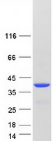 VSX1 Protein - Purified recombinant protein VSX1 was analyzed by SDS-PAGE gel and Coomassie Blue Staining