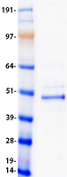 VSX2 / CHX10 Protein - Purified recombinant protein VSX2 was analyzed by SDS-PAGE gel and Coomassie Blue Staining