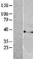 VTA1 Protein - Western validation with an anti-DDK antibody * L: Control HEK293 lysate R: Over-expression lysate