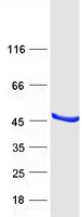 VTA1 Protein - Purified recombinant protein VTA1 was analyzed by SDS-PAGE gel and Coomassie Blue Staining