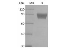 VTCN1 / B7-H4 Protein - Recombinant Human B7 Homolog 4/B7-H4/VTCN1 (C-Fc-Avi) Biotinylated
