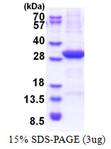 VTCN1 / B7-H4 Protein