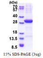 VTCN1 / B7-H4 Protein