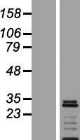 VTI1A Protein - Western validation with an anti-DDK antibody * L: Control HEK293 lysate R: Over-expression lysate