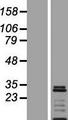VTI1A Protein - Western validation with an anti-DDK antibody * L: Control HEK293 lysate R: Over-expression lysate