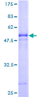VTI1B Protein - 12.5% SDS-PAGE of human VTI1B stained with Coomassie Blue