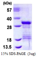 VTI1B Protein