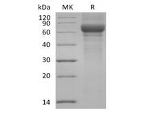 VTN / Vitronectin Protein - Recombinant Human Vitronectin/VTN (N-Truncated, C-6His)