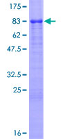VTN / Vitronectin Protein - 12.5% SDS-PAGE of human VTN stained with Coomassie Blue