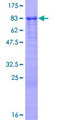 VTN / Vitronectin Protein - 12.5% SDS-PAGE of human VTN stained with Coomassie Blue