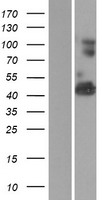 VWA1 / WARP Protein - Western validation with an anti-DDK antibody * L: Control HEK293 lysate R: Over-expression lysate