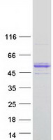 VWA1 / WARP Protein - Purified recombinant protein VWA1 was analyzed by SDS-PAGE gel and Coomassie Blue Staining