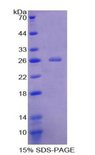 VWA3A Protein - Recombinant Von Willebrand Factor A Domain Containing Protein 3A By SDS-PAGE