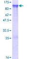 VWA5A Protein - 12.5% SDS-PAGE of human LOH11CR2A stained with Coomassie Blue