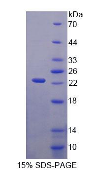VWA5B2 Protein - Recombinant Von Willebrand Factor A Domain Containing Protein 5B2 (vWA5B2) by SDS-PAGE