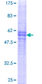 VWF / Von Willebrand Factor Protein - 12.5% SDS-PAGE of human VWF stained with Coomassie Blue