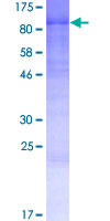 WAC Protein - 12.5% SDS-PAGE of human WAC stained with Coomassie Blue