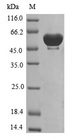 WARS Protein - (Tris-Glycine gel) Discontinuous SDS-PAGE (reduced) with 5% enrichment gel and 15% separation gel.