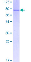 WARS Protein - 12.5% SDS-PAGE of human WARS stained with Coomassie Blue