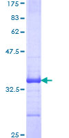 WARS Protein - 12.5% SDS-PAGE Stained with Coomassie Blue.